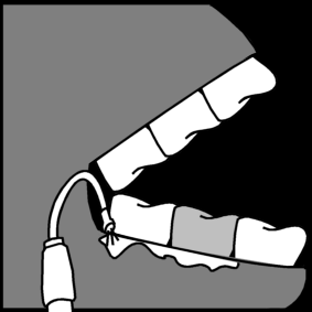 dentist: tools & techniques